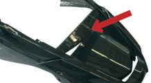 BMW R1200GS, R1200GS Adventure & HP2 Carbon Aerial Conductor